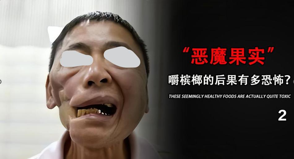 嚼槟榔20年患口腔癌,嚼槟榔20年患口腔癌几率大吗